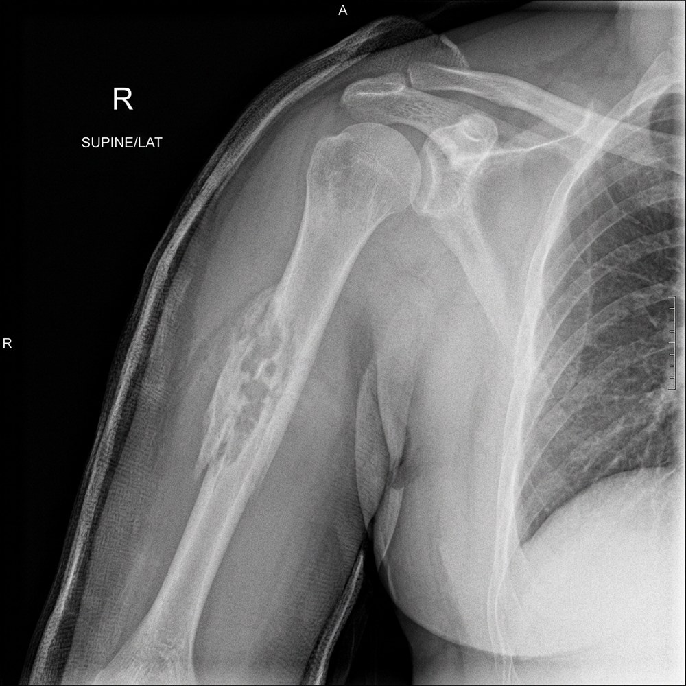 Synthetic extremity X-ray-style image
