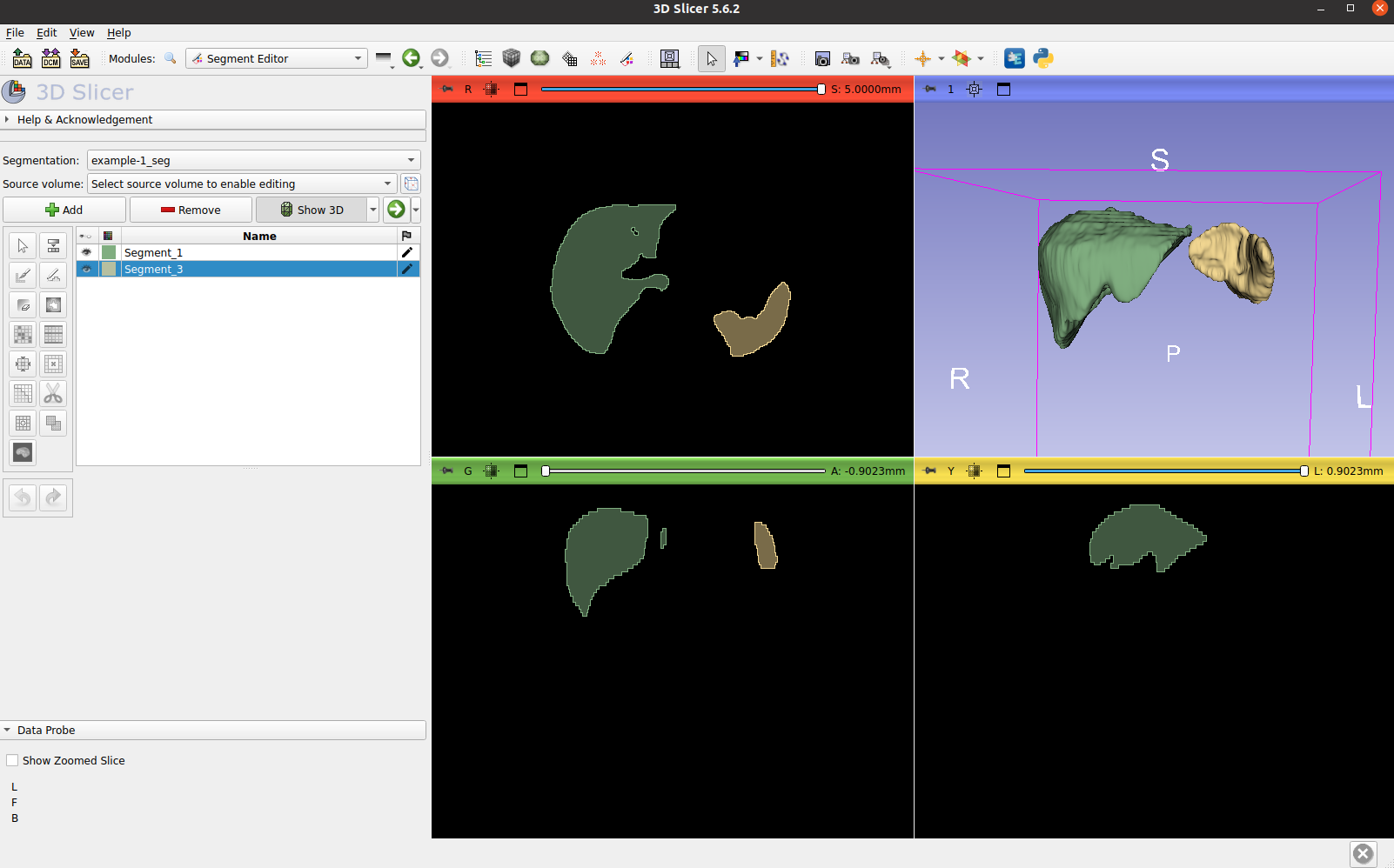 3D Slicer Rendering Example 3