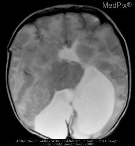 Sample image from the MedPix dataset